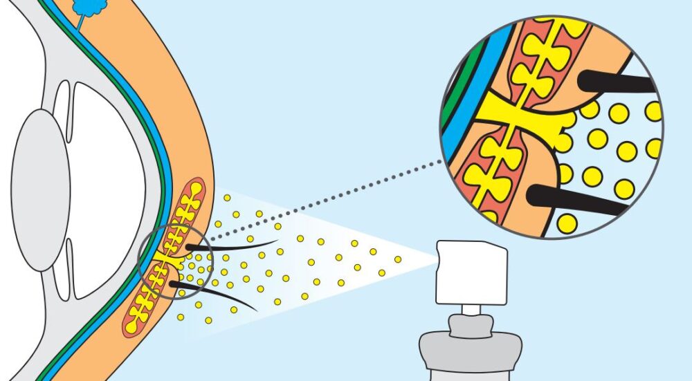 Eye disease, Central Europe