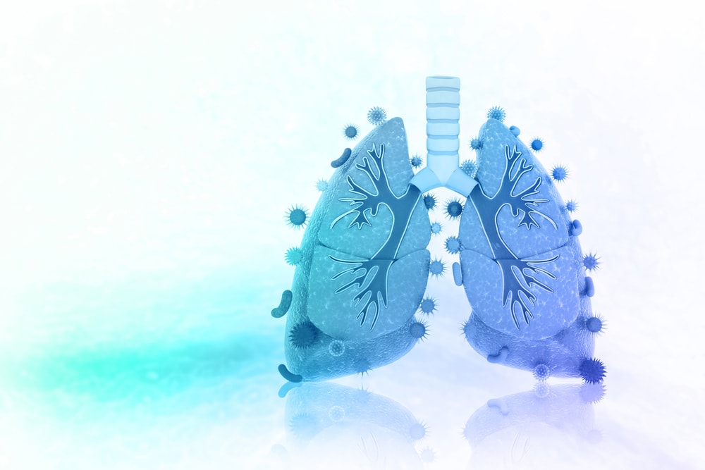 Viruses and bacteria infect a human lung